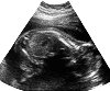 Click for stort billede